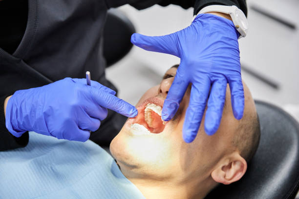 Best Emergency Treatment for Oral Infections in Honeygo, MD