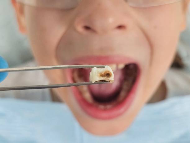 Best Emergency Care for Gum Disease in Honeygo, MD